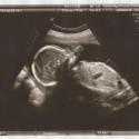 Ultraljud: Bebis i vecka 19