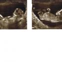 Ultraljud: Min första bild på bebisen :)