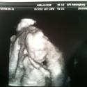 Baby: 3d ultraljud